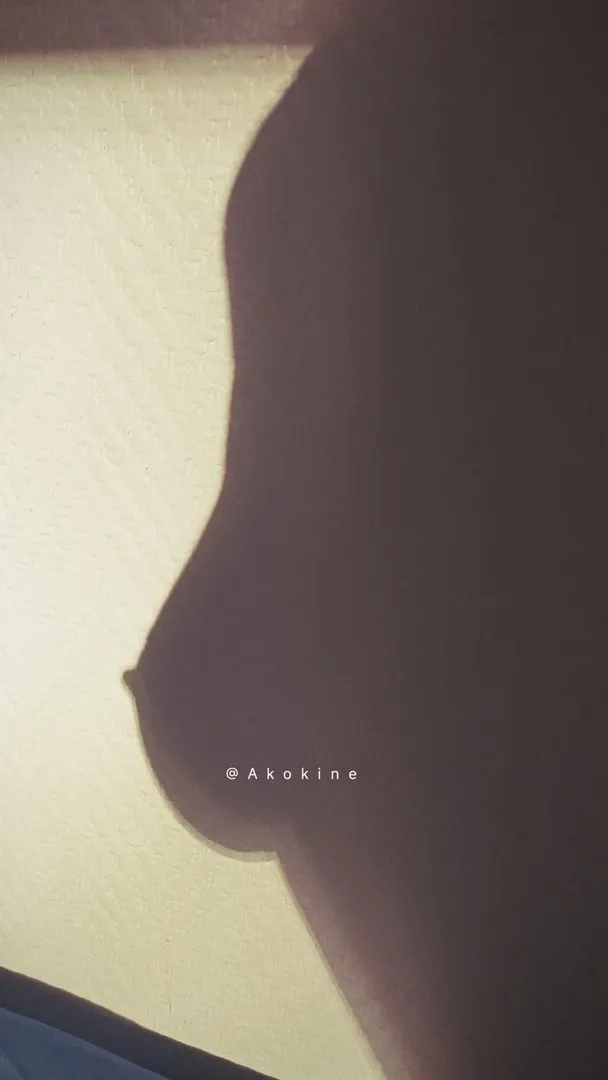 Photo de Akokine - MYM